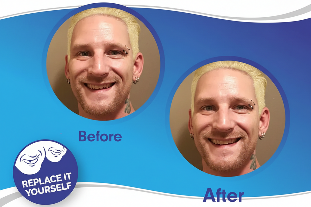 Full Dental Veneer Kit – Upper & Lower Cosmetic Covers