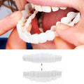 Full Dental Veneer Kit – Upper & Lower Cosmetic Covers